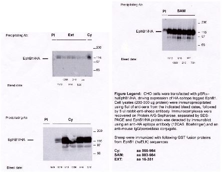 "Legend: CHO cells were trasfected with pSR-α huEphB1/HA, driving expression of HA epitope tagged EphB1.  Cell lysates (200-300µg protein) were immunoprecipitated using 5 µl rabbit-anti-sheep antibody.  Immunocomplexes were recovered on Protein A/G-Sepharose, separated by SDS-PAGE and EphB1/HA protein was detected by immunoblot using an anti-HA epitope antibody (Cat. No. X1000), and an anti-mouse IgG/peroxidase conjugate.  Sheep were immunized with the following GST fusion proteins from EphB1 (huELK) sequences:
Cy:  aa 566-984
SAM: aa 883-984
EXT: aa 16-351"